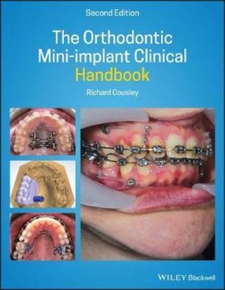 The Orthodontic Mini-implant Clinical Handbook by Richard Cousley (US edition, paperback)