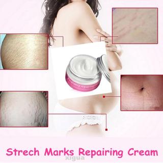 Pregnancy Repairing Cream Strech Marks Scars Obesity Pattern Removal