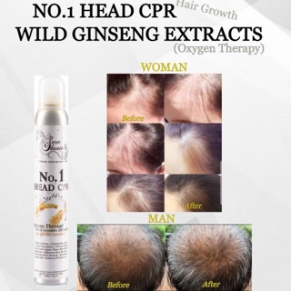 No. 1 Head CPR Oxygen therapy wild ginseng extracts hair tonic, Minty treatment shampoo, Conditioner