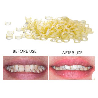 100 pcs Dental Rubber Bands Orthodontic Elastics Braces Teeth Gap (1)