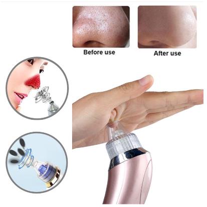 Blackhead Remover Facial Skin Care Acne Vacuum Suction Pore Clean Machine Beauty