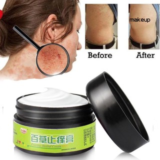 【MK】Effective Herbal Ointment Dermatitis Psoriasis Eczema Cream Anti Itch Paste