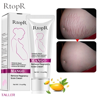 RTOPR Mango Remove Pregnancy Acne Scar Stretch Mark Cream Treatment Maternal Anti-Aging Repair Anti-Wrinkle Firming Body Cream TALLER