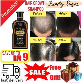 100% Original Ginger Shampoo Hair Growth Shampoo Anti-dandruff Solid Hair Control Anti Hair Loss