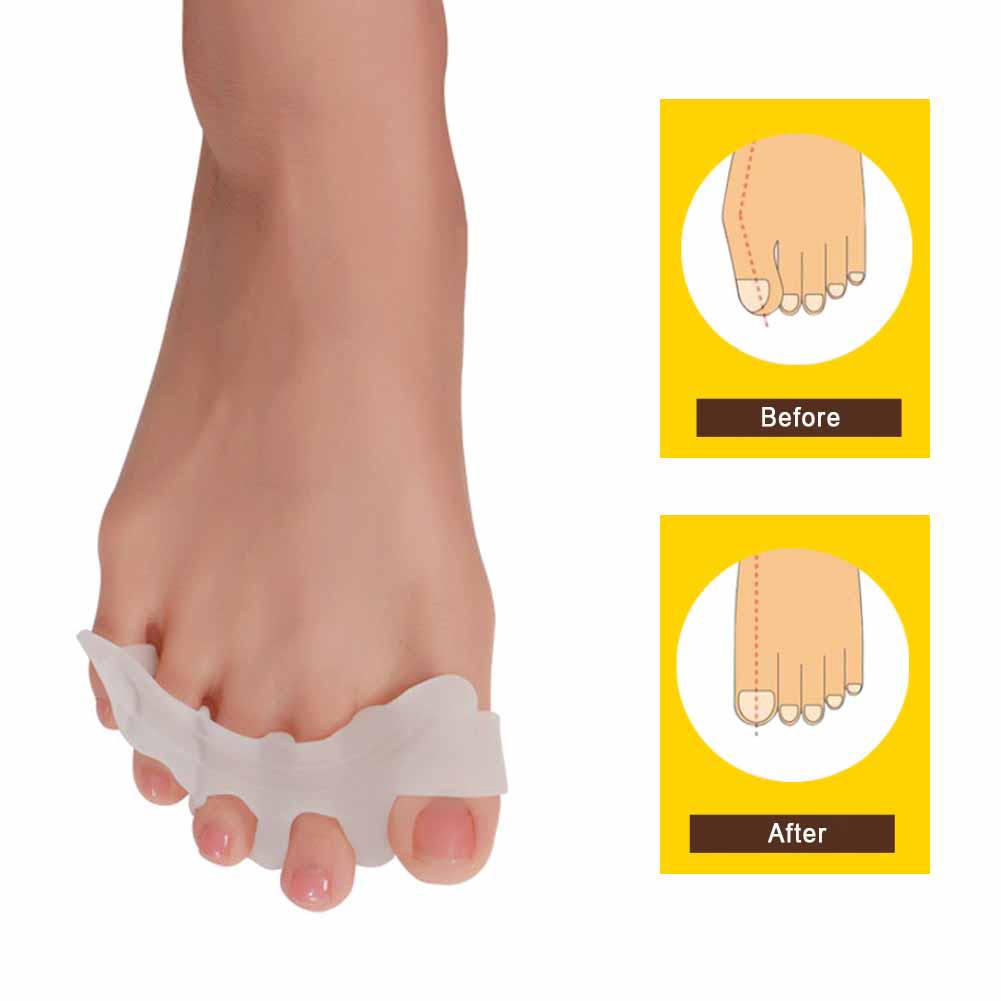 Feet Correct Sandals Women Summer Open Toe Slip On PU Leather 36-43
