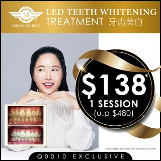 Led Teeth Whitening Treatment (Up to 6-8 shades whiter)Visible results in just one session